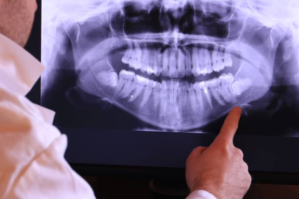 Best Cracked Tooth Emergency Dentist  in Galveston, IN