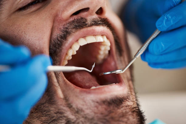 Best Teeth Whitening  in Galveston, IN