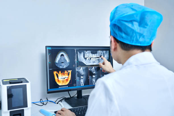 Best Chipped Tooth Repair Near Me  in Galveston, IN